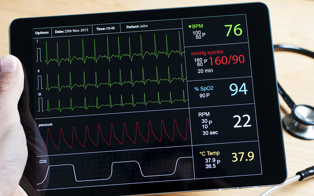 Electrocardiogram (EKG) test.